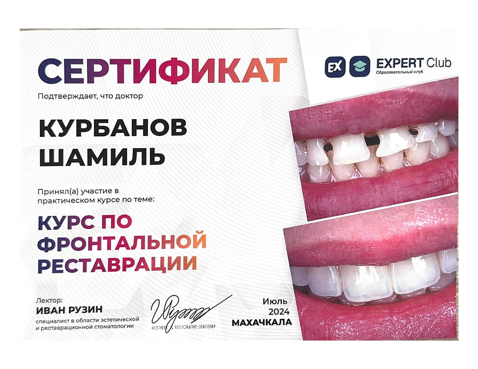 Курбанов Шамиль Тагирович — врач стоматологии Blanco
